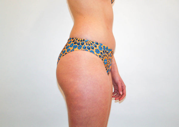 Jaki Bottoms – Golden Yellow Hippie Floral